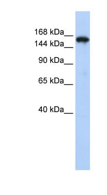 SYNJ1 / Synaptojanin Antibody (aa147-196)