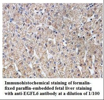 Polyclonal Rabbit anti-Human EGFL6 Antibody (aa30-219, IHC, WB)