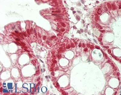 IHC-plus™ Polyclonal Rabbit anti-Human SATB2 Antibody (aa683-733, IHC, WB)