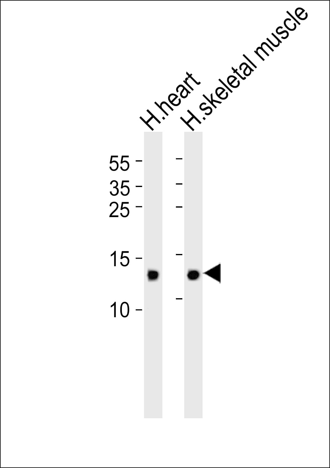 FABP3 / H-FABP Antibody