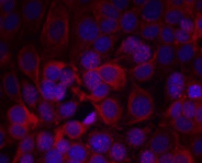 ERBB2 / HER2 Antibody