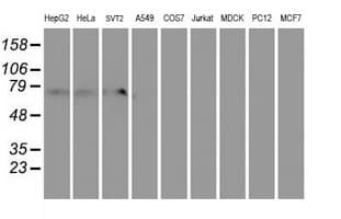 MTFMT Antibody (aa175-389, clone OTI1C1)