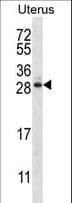 ARL8A Antibody (aa82-110)