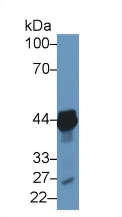 TACR2 / NK2R Antibody (aa92-290)