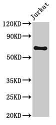 Polyclonal Rabbit anti-Human GNL1 Antibody (WB)