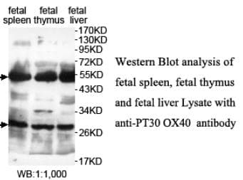 IHC-plus™ TNFRSF4 / CD134 / OX40 Antibody (N-Terminus)