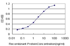 FTCD / 58K Golgi Protein Antibody (clone 3A4)