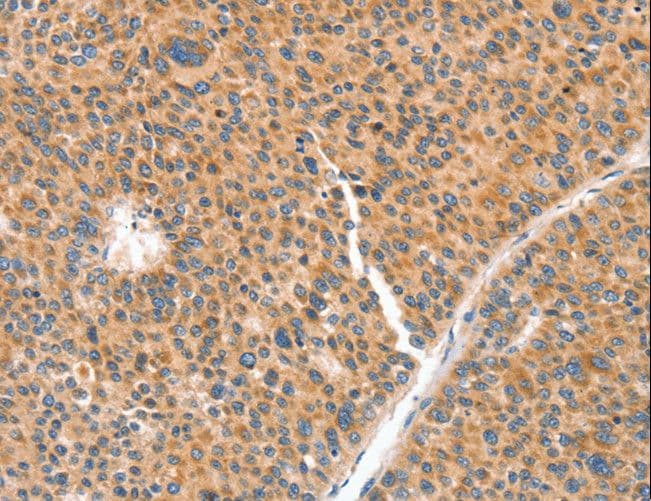 NUAK1 / ARK5 Antibody