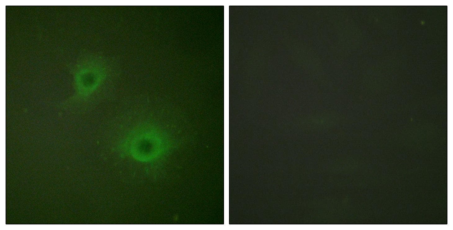 Ephrin B1+B2 Antibody (p594/604)