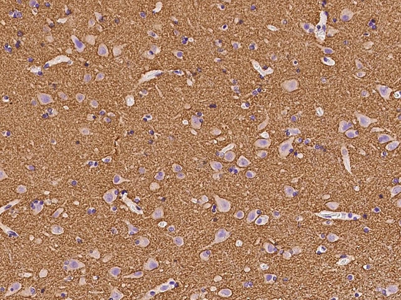 Polyclonal Rabbit anti-Human GAP43 Antibody (Preservative Free, IHC, WB)