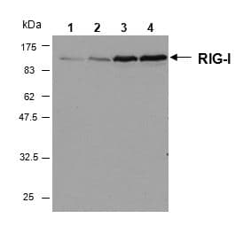 DDX58 / RIG-1 / RIG-I Antibody (aa201-713, clone Alme-1)