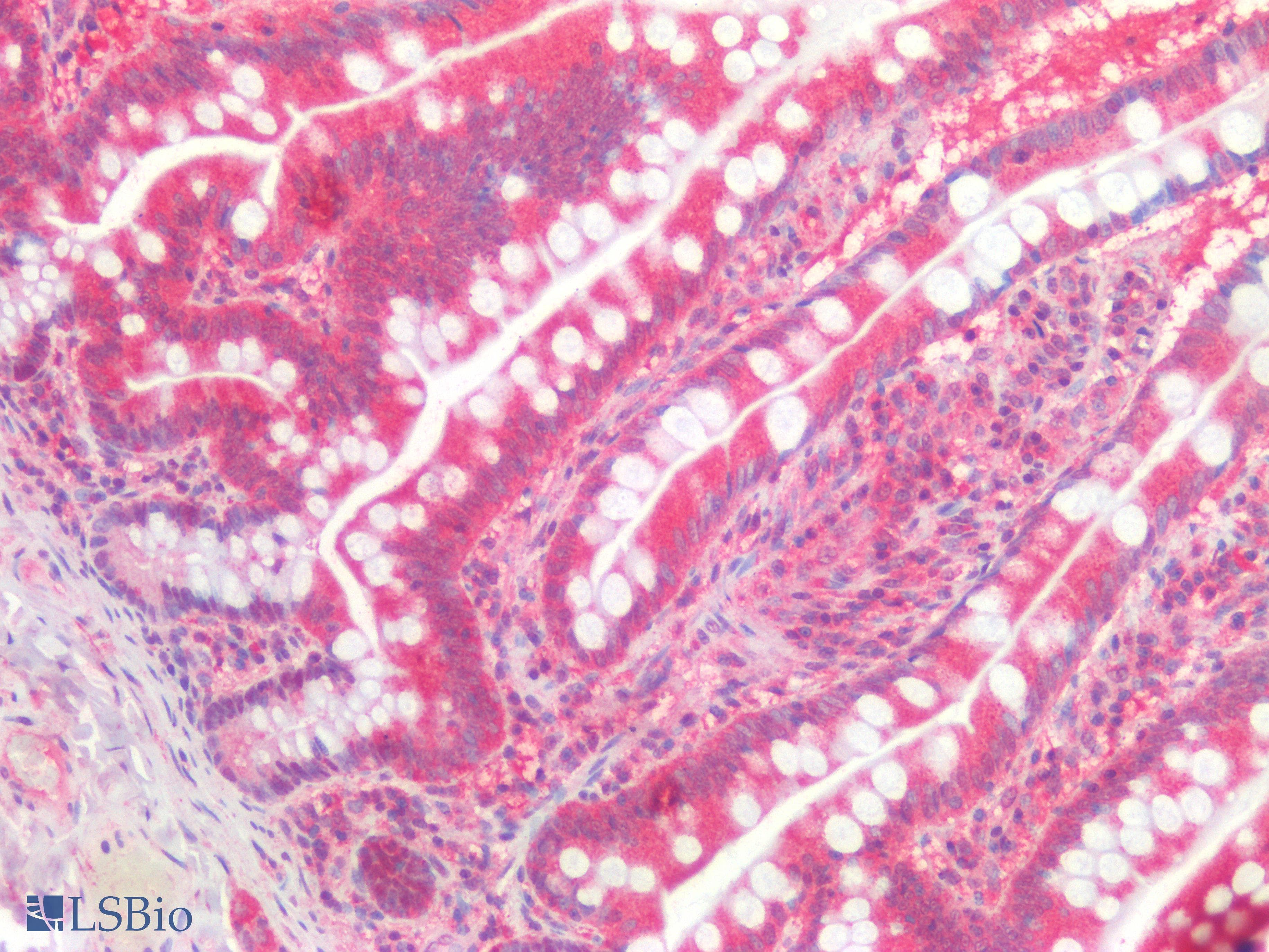 IHC-plus™ Polyclonal Rabbit anti-Human GATA3 Antibody (IHC)