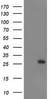 AK4 / Adenylate Kinase 4 Antibody (clone OTI5B10)