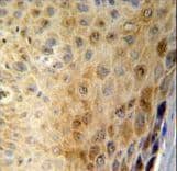 Polyclonal Rabbit anti-Human GSDMA Antibody (aa66-94, IHC, WB)