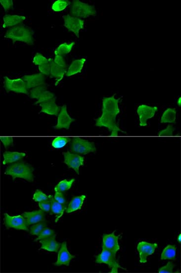 GLUL / Glutamine Synthetase Antibody
