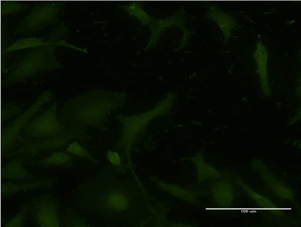 ATM Antibody (clone 2C10)