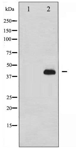Polyclonal Rabbit anti-Human NCF1 / p47phox / p47 phox Antibody (phospho-Ser359, IHC, IF, WB)