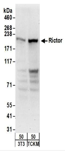 IHC-plus™ RICTOR Antibody (aa1650-C-term)
