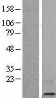 Human B2M / Beta 2 Microglobulin Protein (Over-Expression Lysate Myc-DDK (Flag))