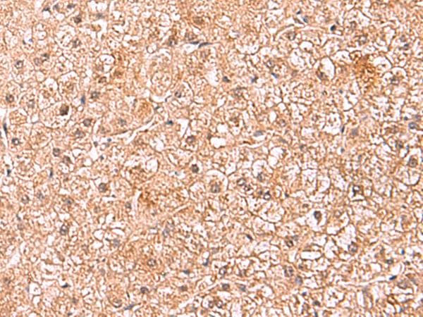Polyclonal Rabbit anti-Human ASTN2 Antibody (aa1120-1339, IHC)