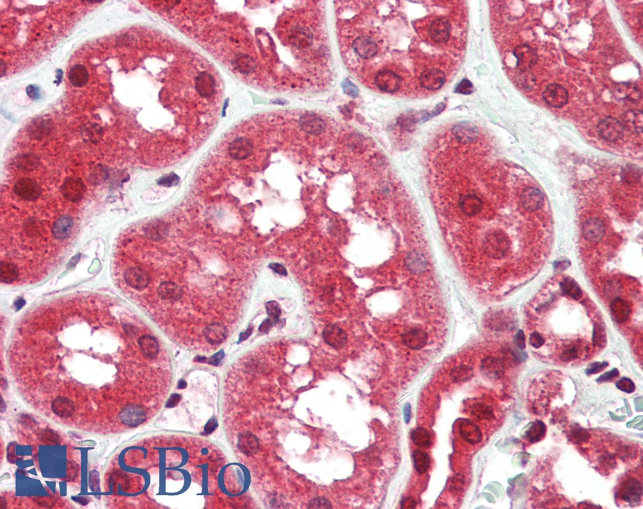 IHC-plus™ RASD2 Antibody