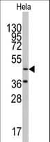 NARS2 Antibody (aa445-474)