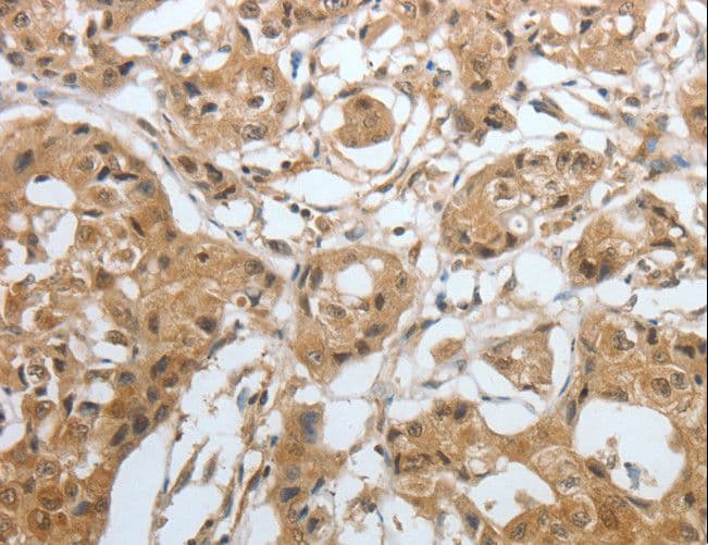 AMPH / Amphiphysin Antibody