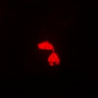 Polyclonal Rabbit anti-Human PSME3 Antibody (IF, WB)
