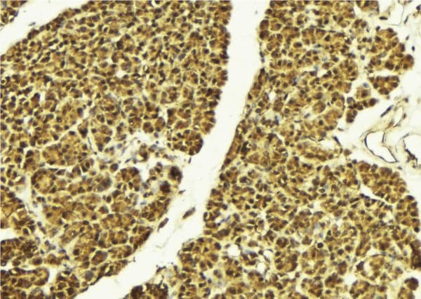 Polyclonal Rabbit anti-Human MAPK14 / p38 Antibody (phospho-Tyr323, IHC, IF, WB)