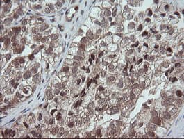 OTUB1 / OTU1 Antibody (clone OTI1E3)