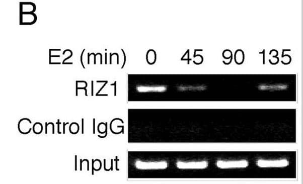 PRDM2 / RIZ1 Antibody (clone 33AT1045)