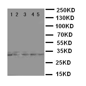 E2F6 Antibody (aa162-177)