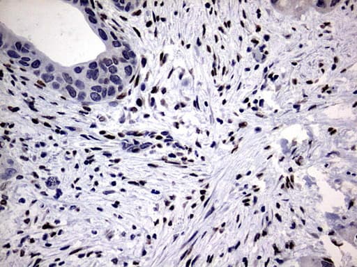 Monoclonal Mouse anti-Human PRX-1 / PRRX1 Antibody (clone OTI6A4, IHC, WB)