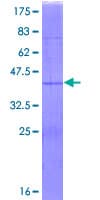 Human RPS15A Protein (Recombinant GST)