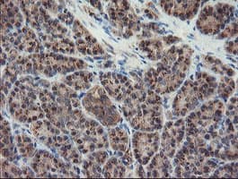 DPH2 Antibody (clone OTI4E7)