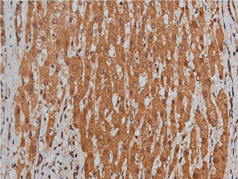 BMP3 Antibody