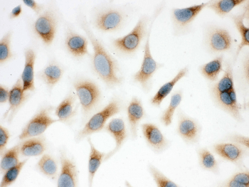SFTPD / Surfactant Protein D Antibody