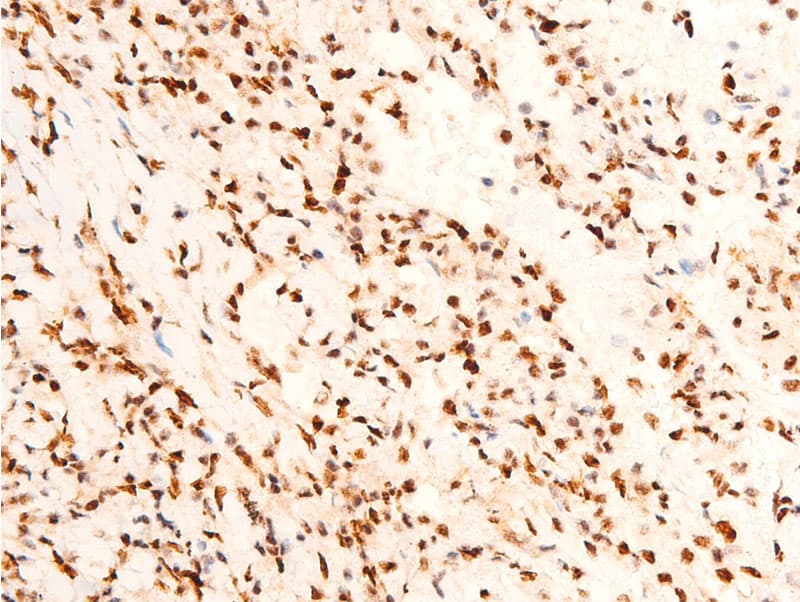 Polyclonal Rabbit anti-Human JUN / c-Jun Antibody (phospho-Thr91, IHC, WB)