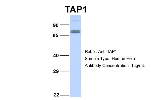 ABCB2 / TAP1 Antibody (aa504-553)