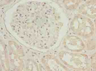 Polyclonal Rabbit anti-Human TUBB1 / Tubulin Beta 1 Antibody (IHC, WB)