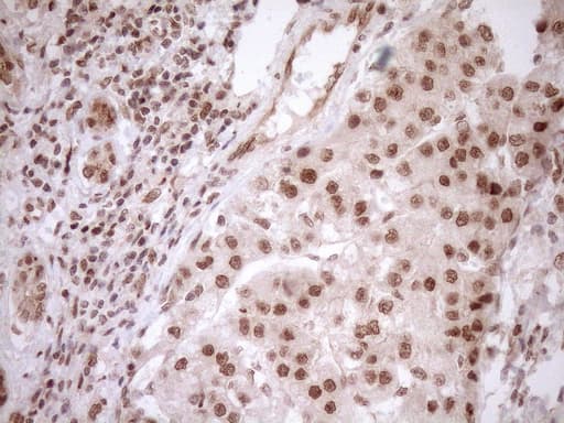 NUDT21 Antibody (aa2-227, clone OTI2C8)