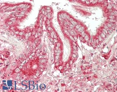 IHC-plus™ ARSA / Arylsulfatase A Antibody