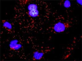 IHC-plus™ CDH1 / E Cadherin Antibody (clone 3F4)