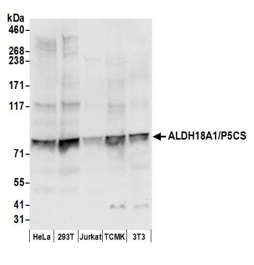 ALDH18A1 Antibody (aa575-625)