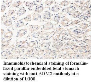 Polyclonal Rabbit anti-Human ADM2 / Adrenomedullin 2 Antibody (C-Terminus, IHC)