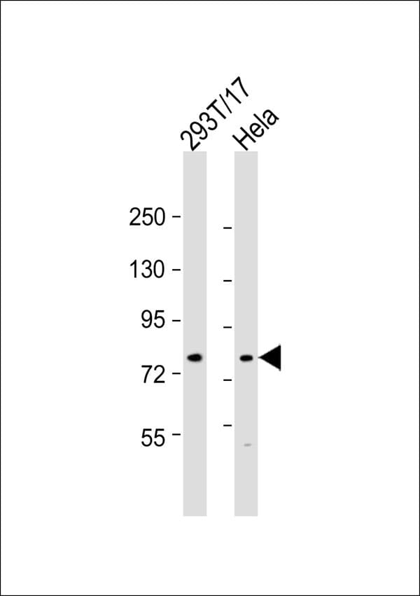 Polyclonal Rabbit anti-Human CEP78 / IP63 Antibody (WB)