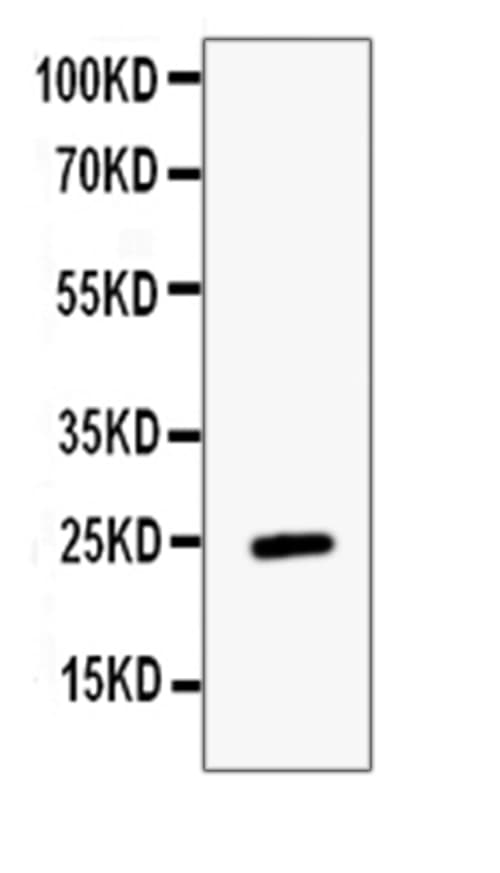 ESM1 / Endocan Antibody
