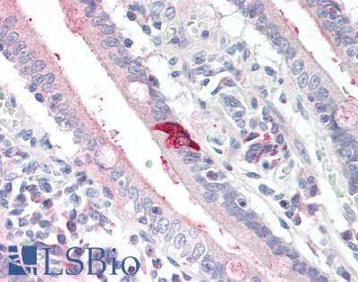 CCK / Cholecystokinin Antibody (aa1-115)