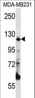PITRM1 / MP1 Antibody (aa490-518)