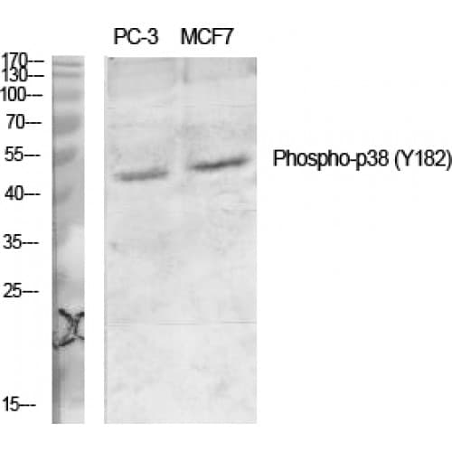 MAPK14 / p38 Antibody (120-200 aa)